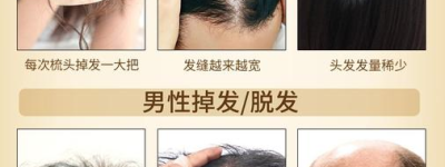护发黑发秘诀：定期检查，防脱增发，秀发重