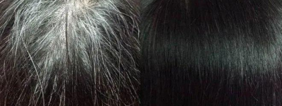 黑发秘笈：食疗增发，告别脱发，秀发浓密如